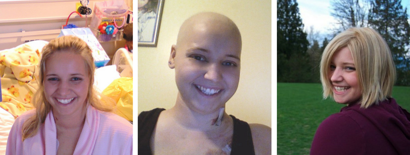 Balding For Dollars Transformation
